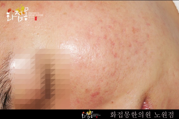 전후사진