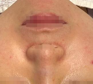 전후사진