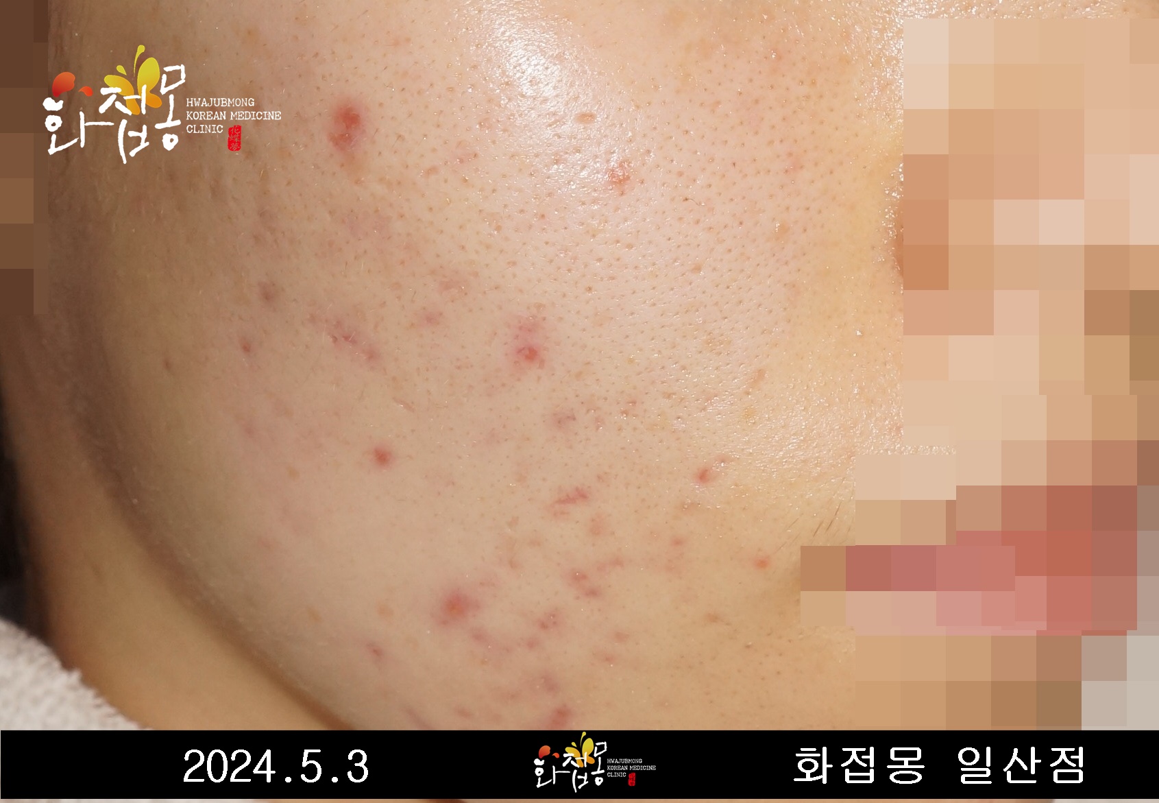 전후사진