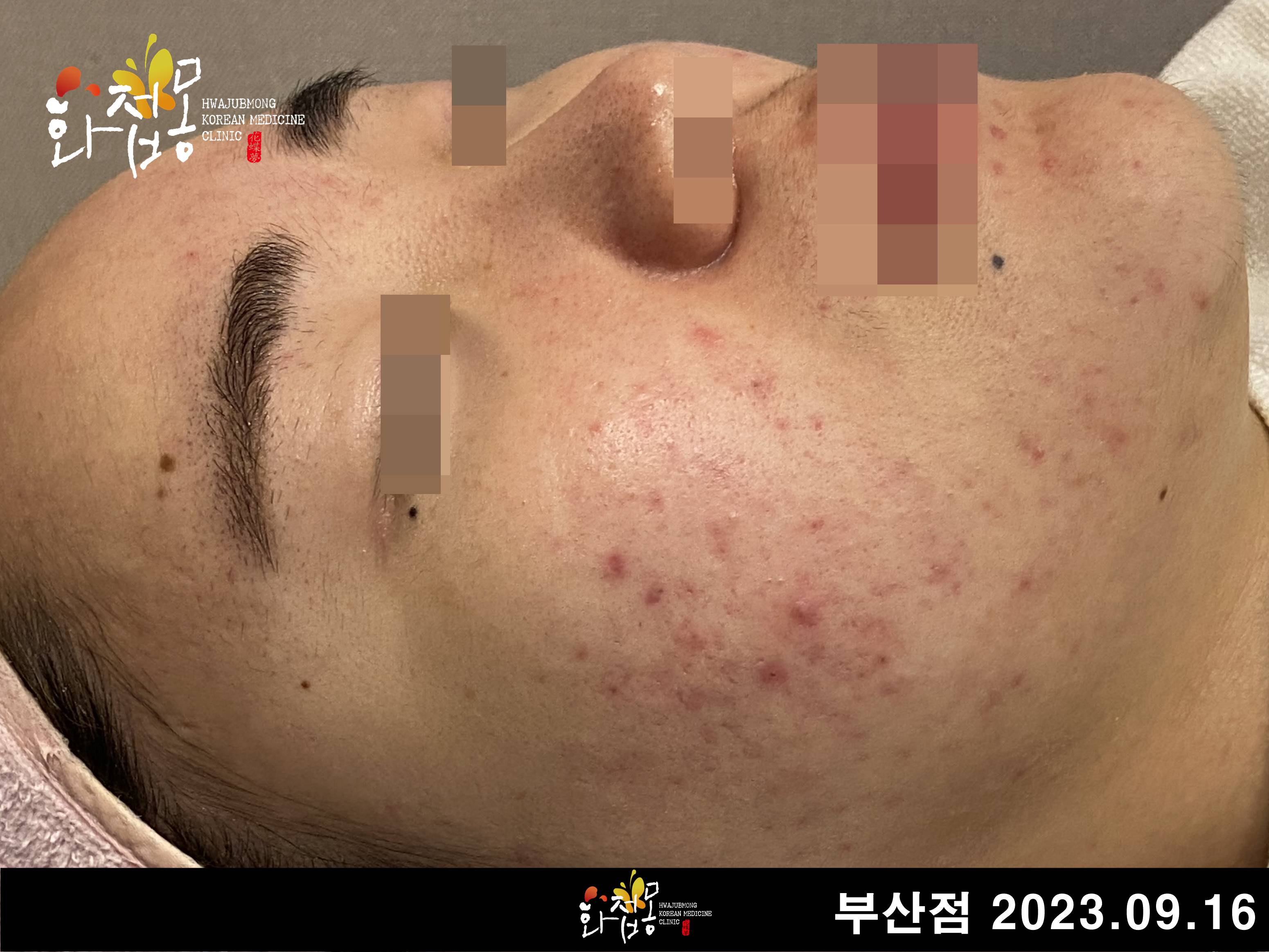 전후사진