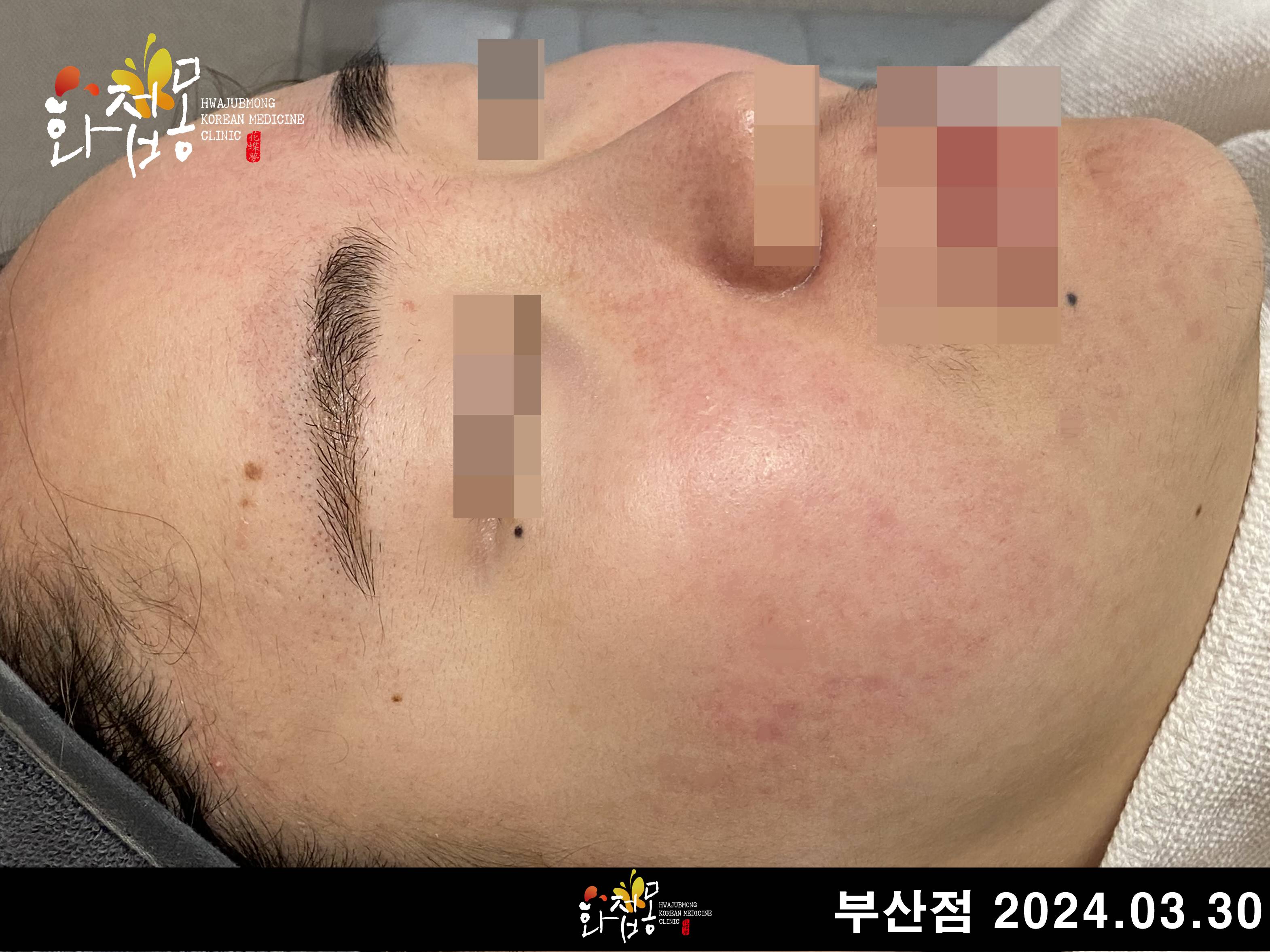 전후사진