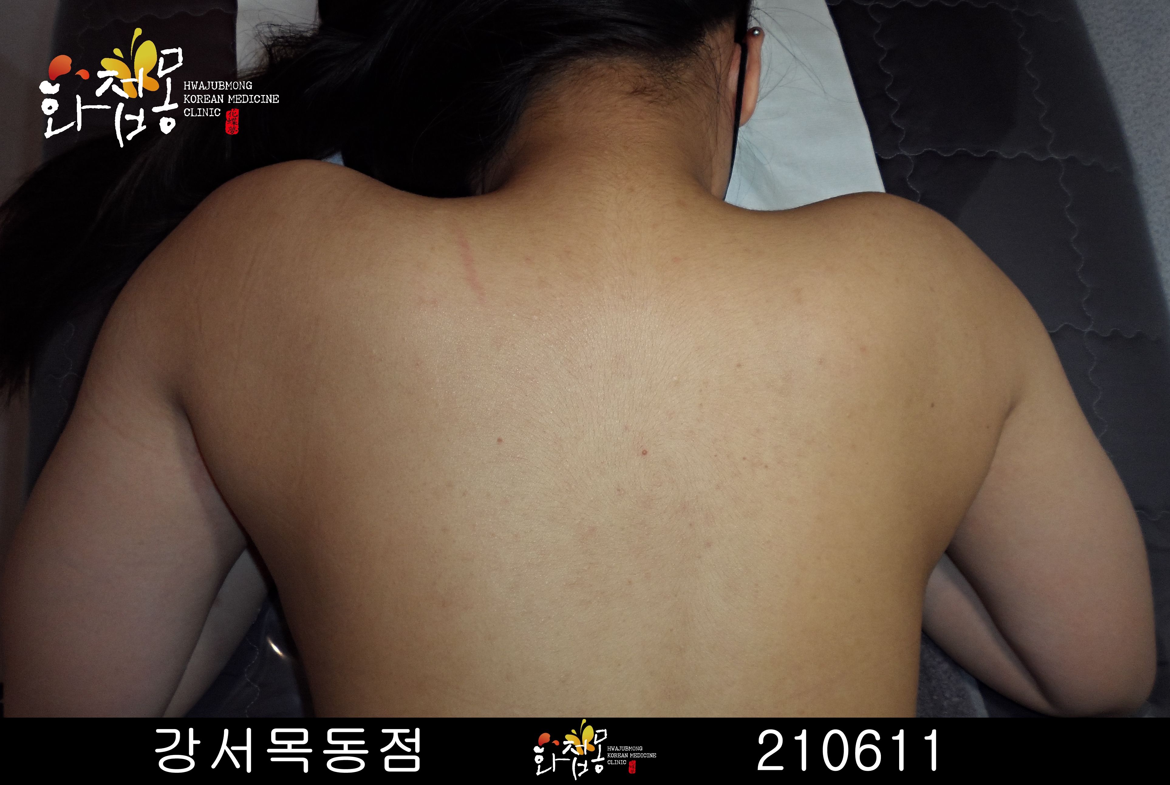 전후사진