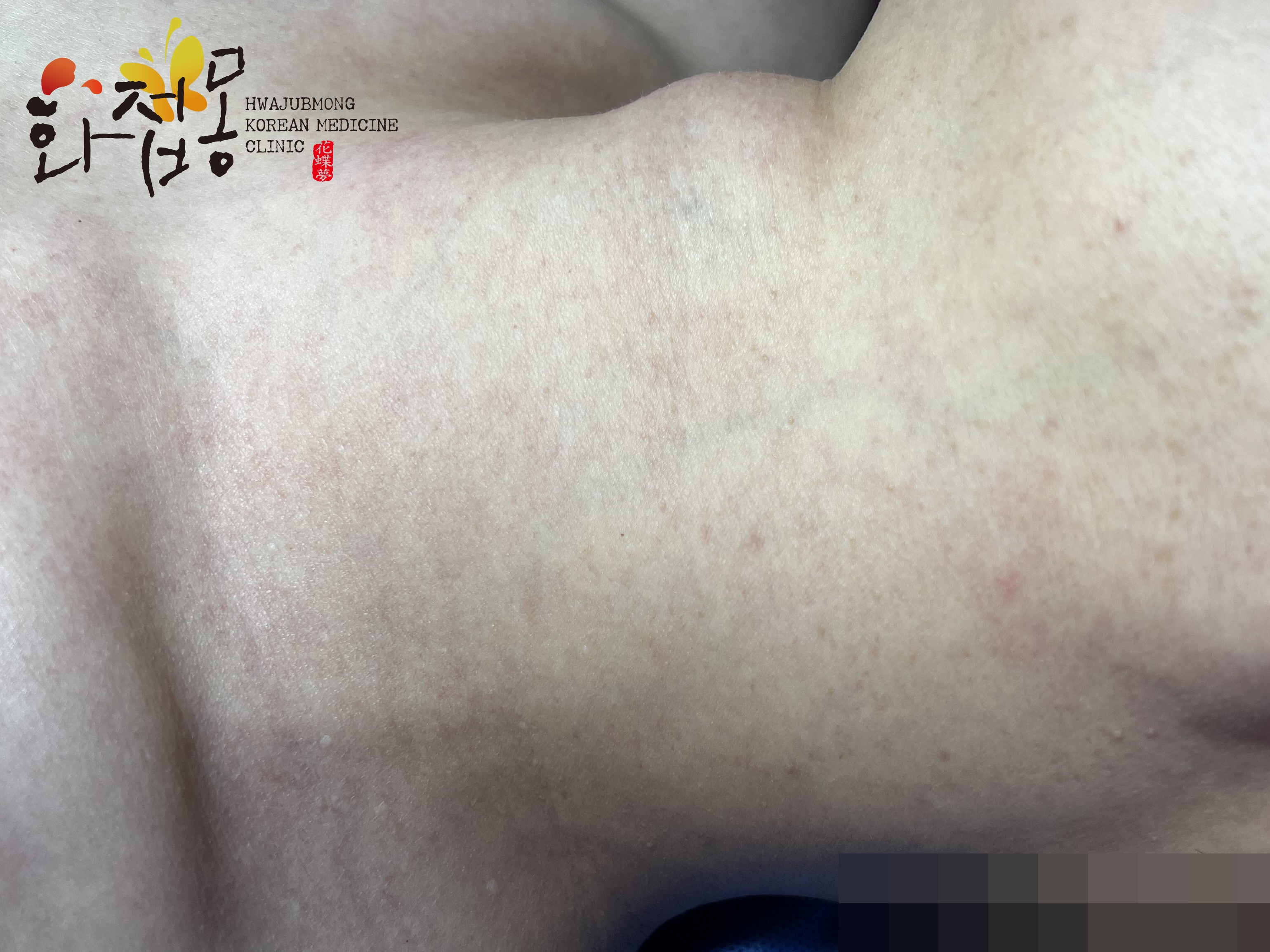 전후사진