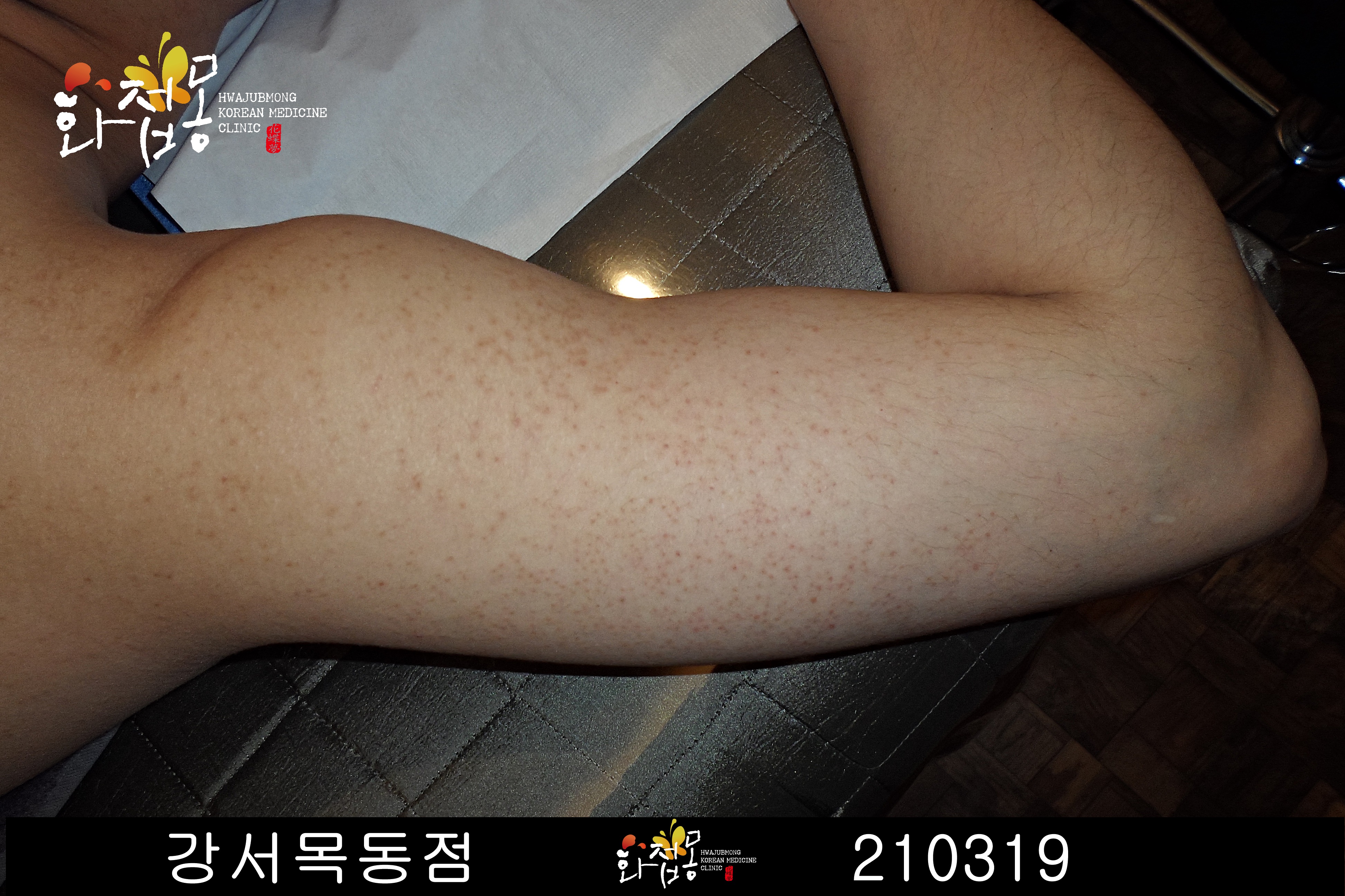 전후사진