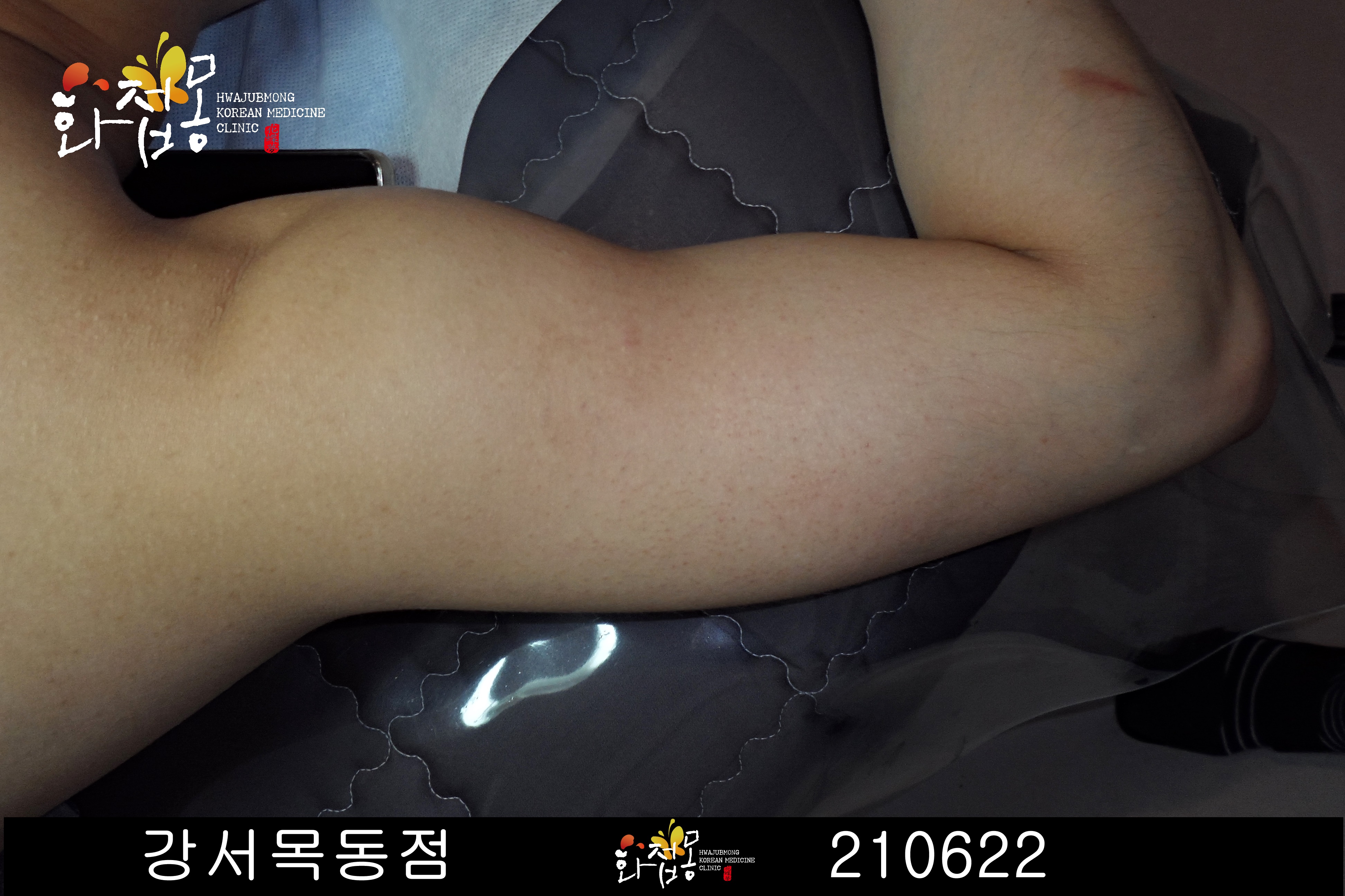 전후사진