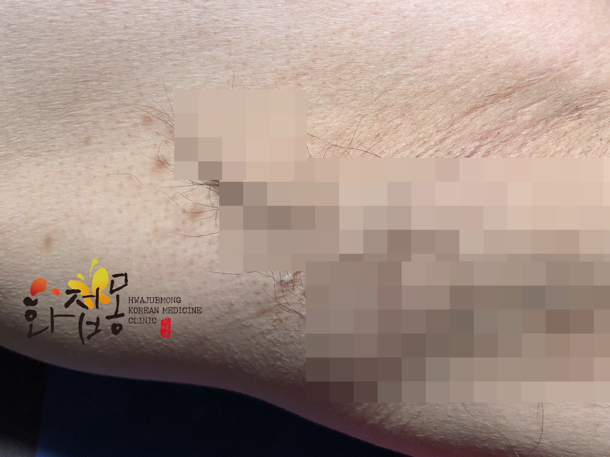 전후사진