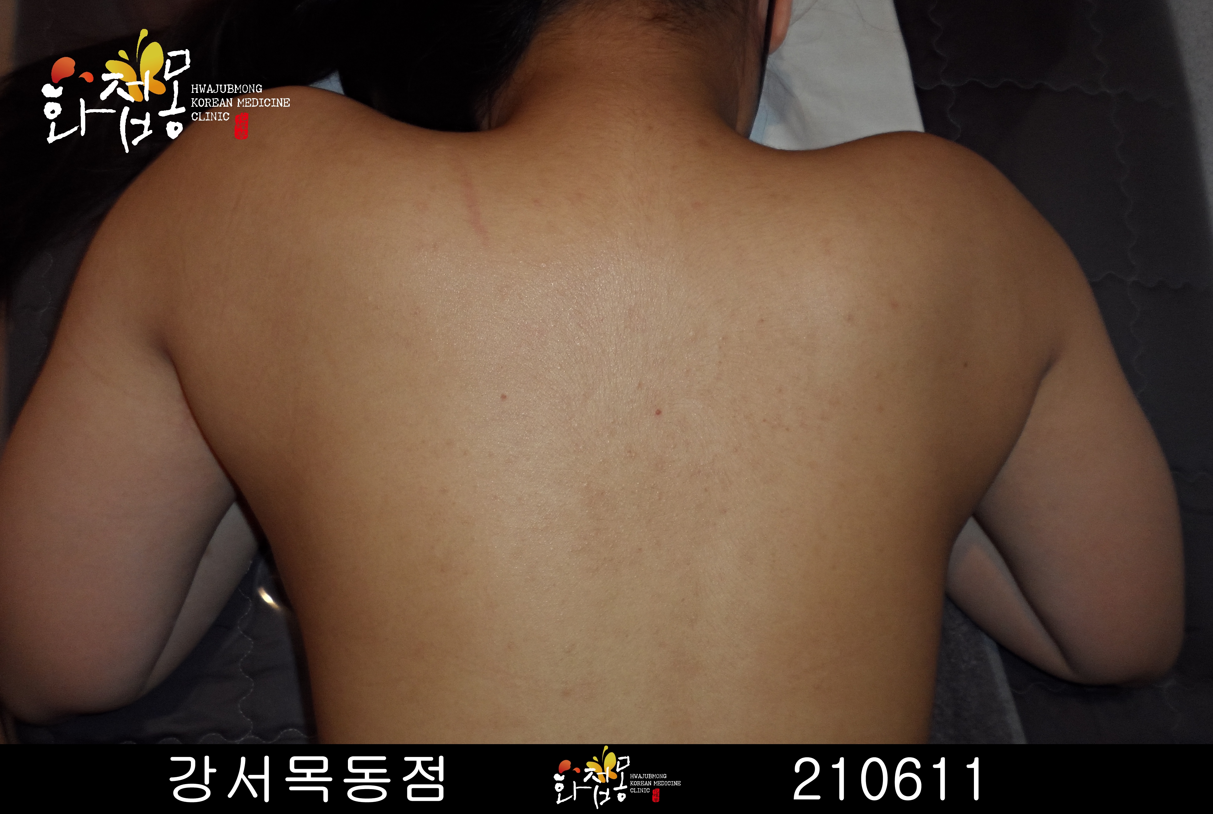 전후사진