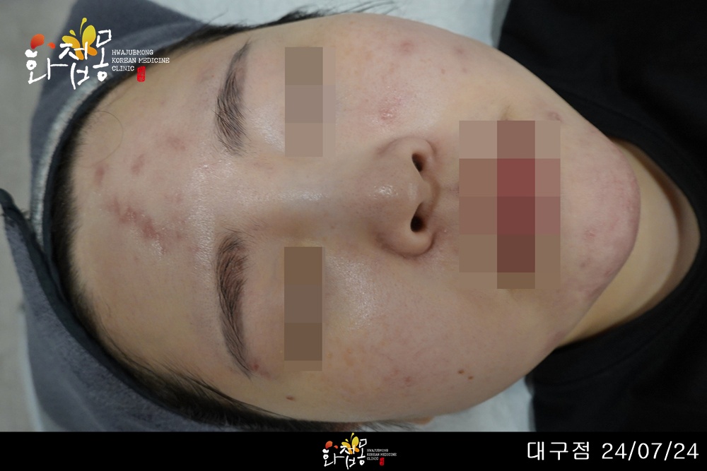전후사진