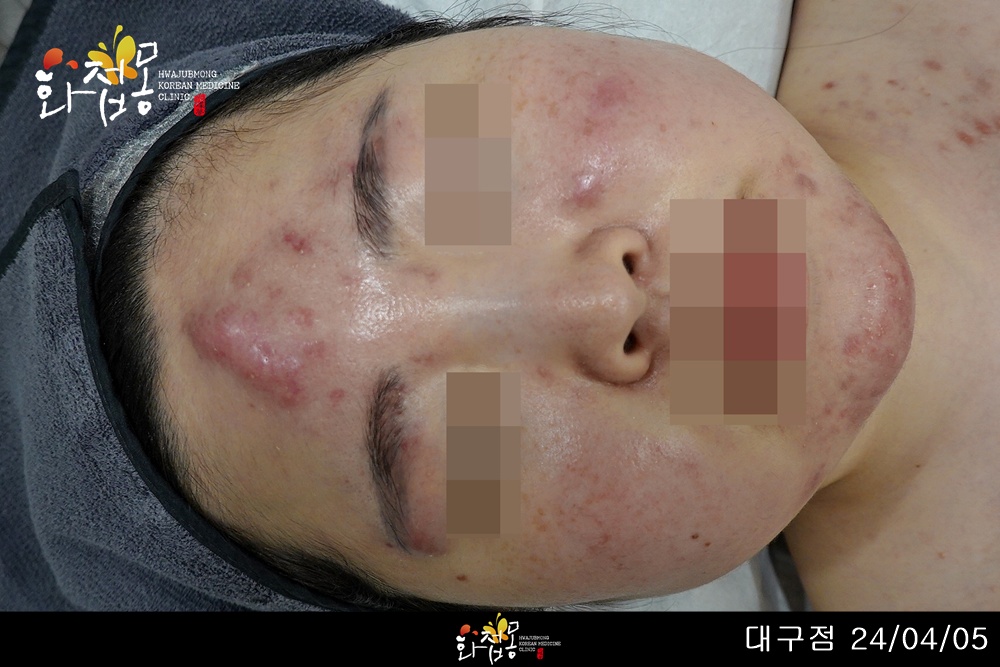 전후사진
