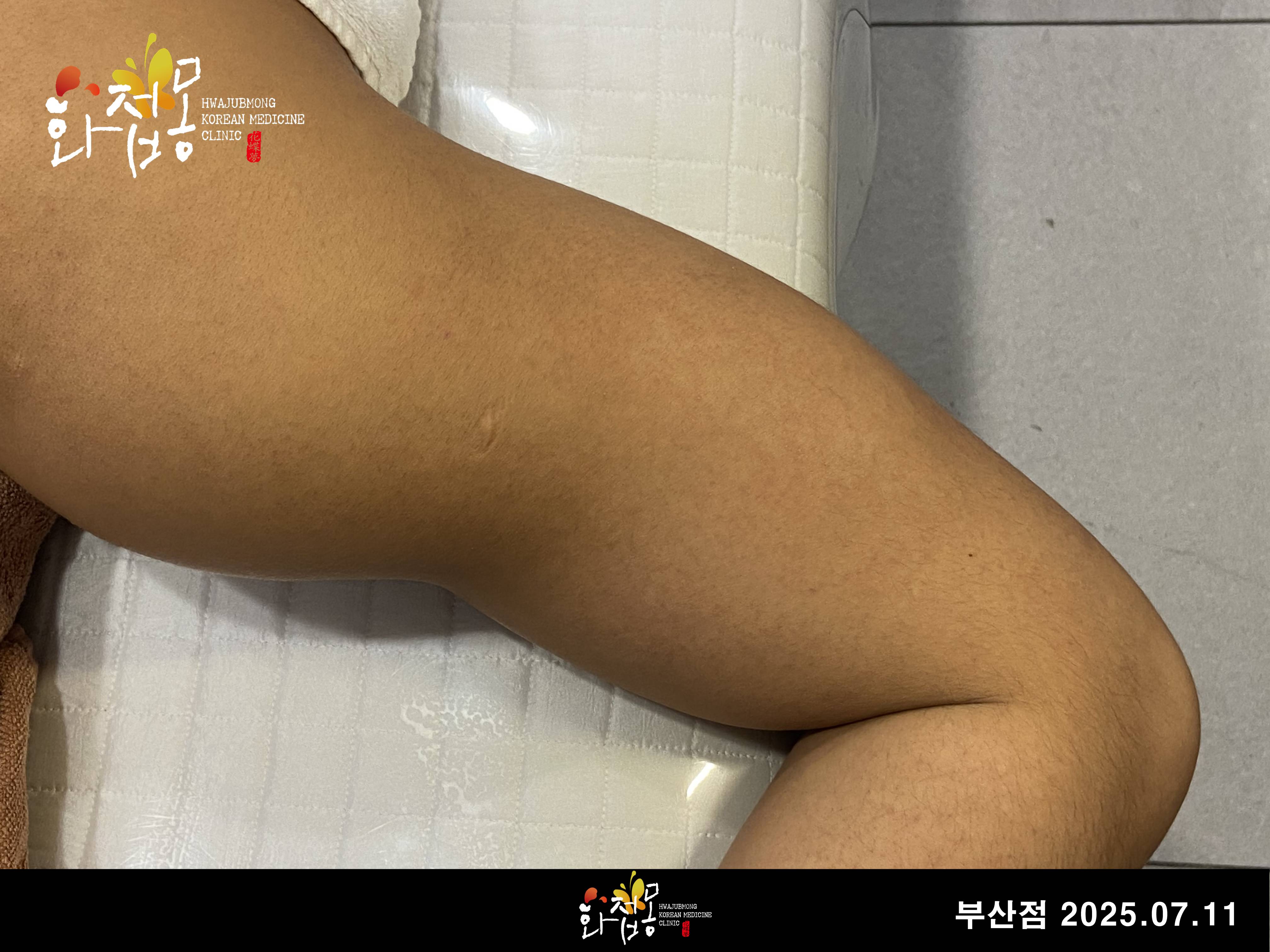전후사진