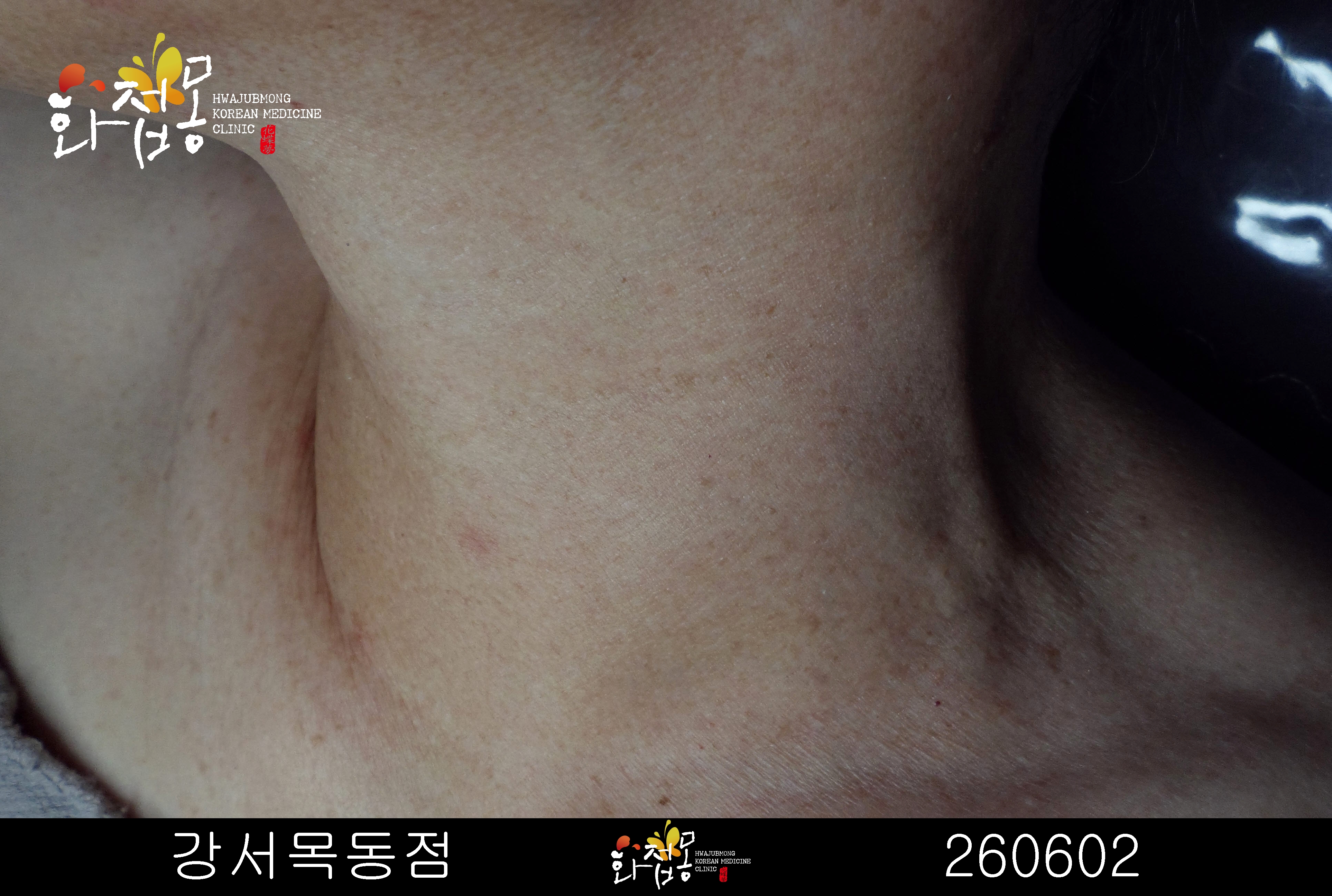 전후사진