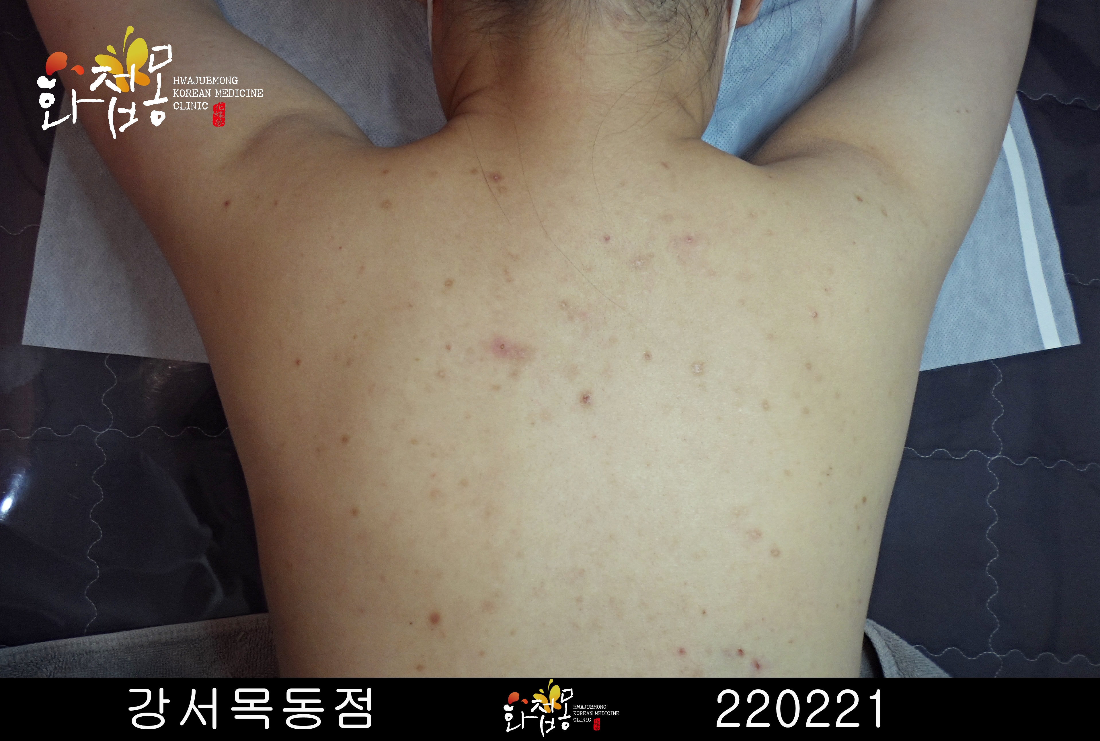 전후사진