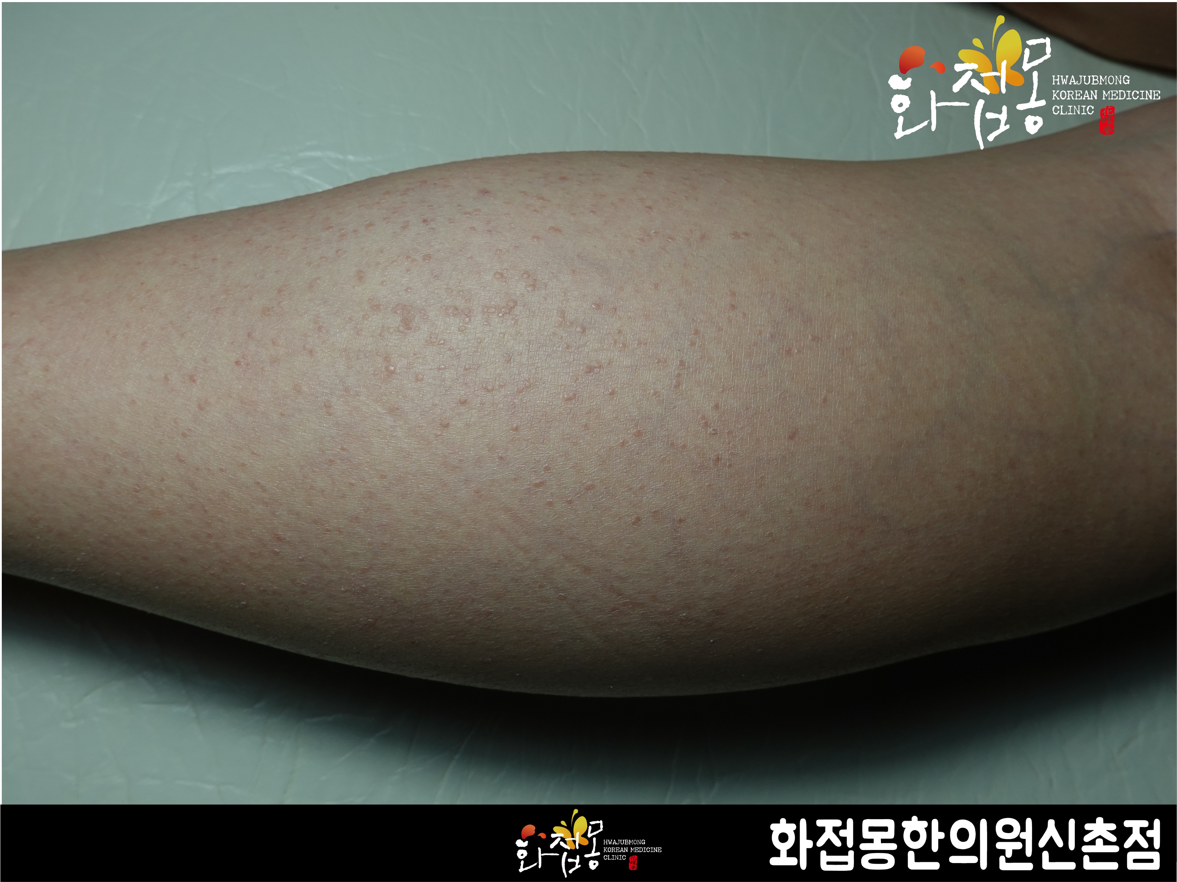 전후사진