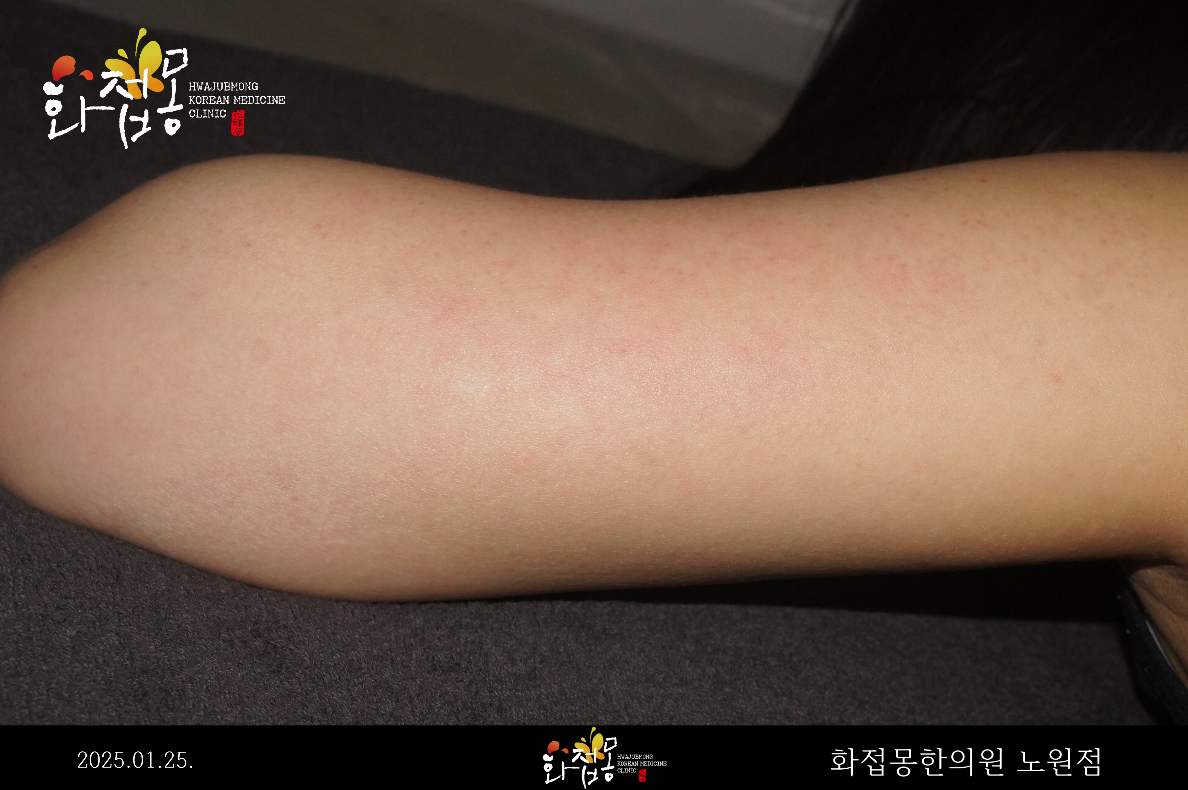전후사진