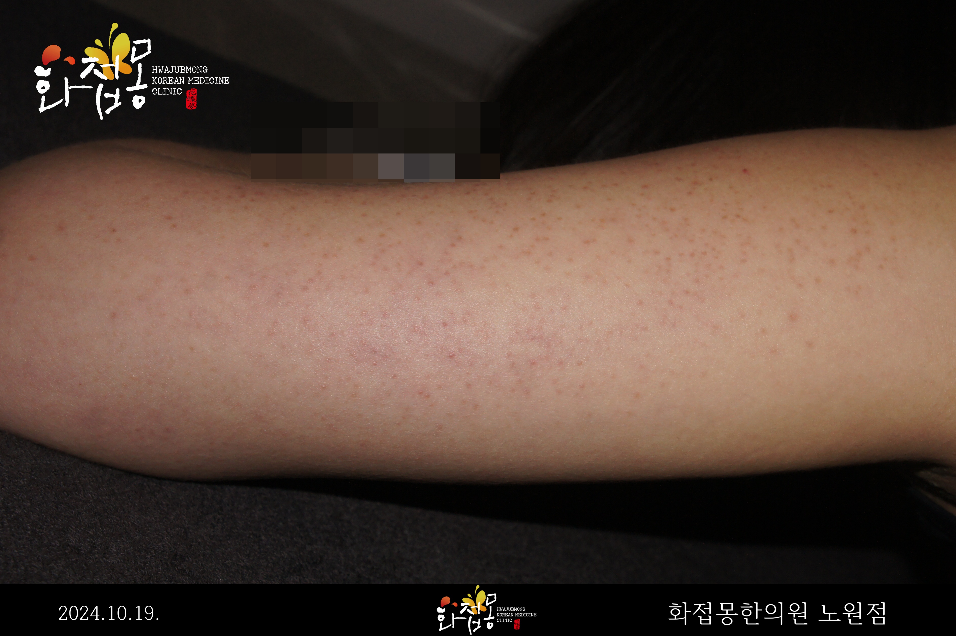 전후사진