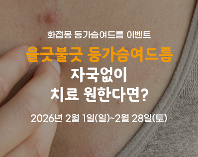 등가슴여드름_이벤트