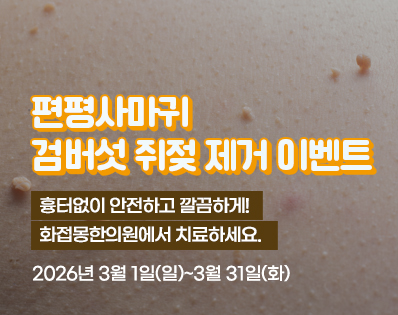 편평사마귀 _39이벤트