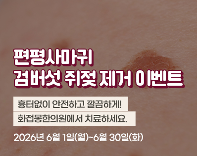 편평사마귀 _29이벤트