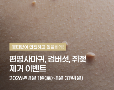 편평사마귀 _39이벤트