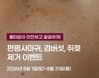 편평사마귀 _29이벤트