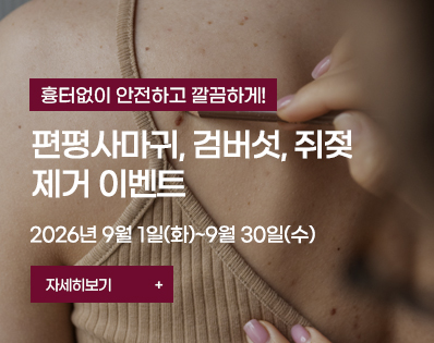 편평사마귀 _29이벤트