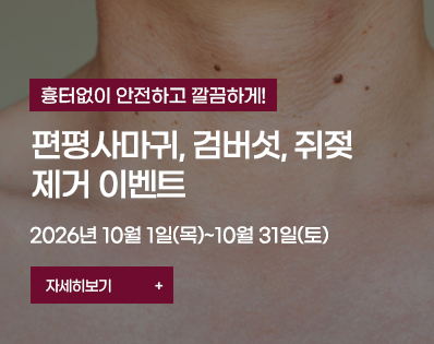 편평사마귀 _29이벤트