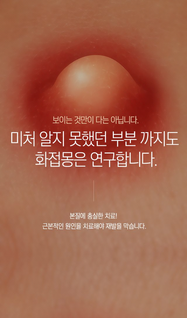 모낭염