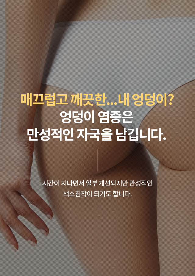 지루성피부염