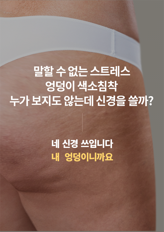 지루성피부염