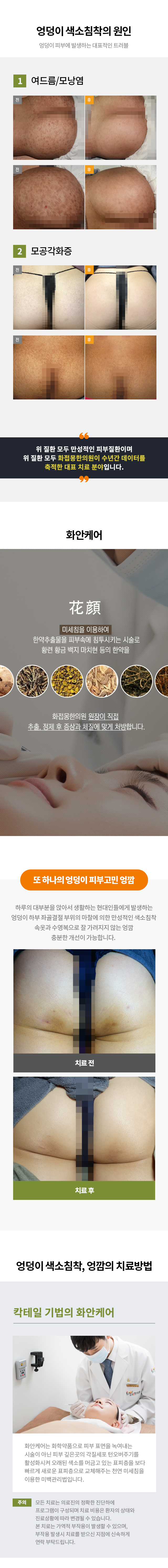 지루성피부염